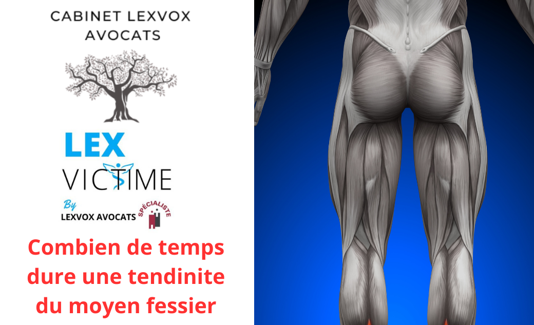 Combien de temps dure une tendinite du moyen fessier - Lexvox Medical
