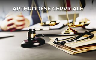 Arthrodèse cervicale
